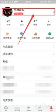 头条的图片怎么设置最大,nn如果图片内容是关于“巴黎铁塔”，副标题可以这样设置：nn“巴黎铁塔：法国象征，历史与现代的交汇点”nn请根据实际图片内容调整上述模板。如果你能提供图片的描述或主题，我可以帮你构思一个合适的副标题。